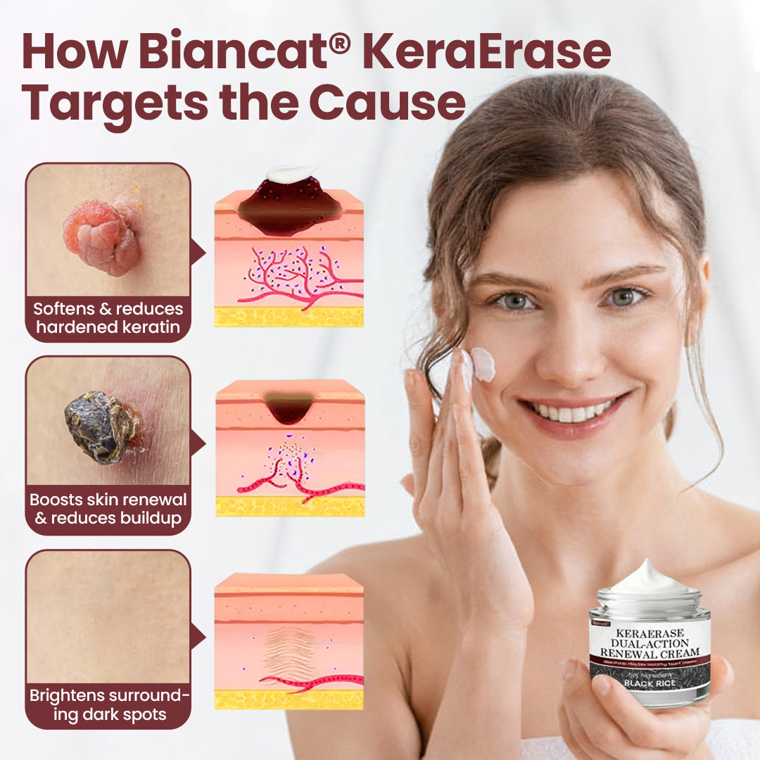 Biancat®KeraErase Dual-Action Renewal Cream  (23