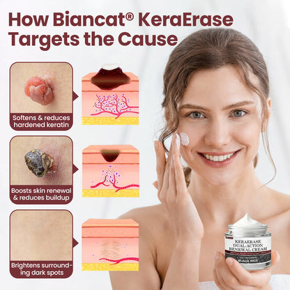 Biancat®KeraErase Dual-Action Renewal Cream  (23